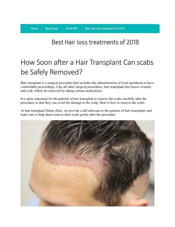 How Soon after a Hair Transplant Can scabs be Safely Removed?