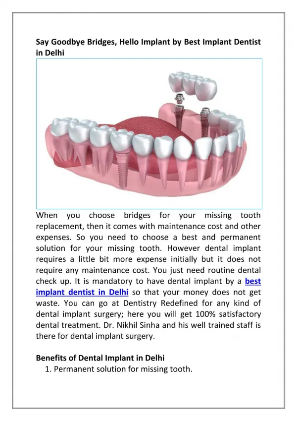 Say Goodbye Bridges, Hello Implant by Best Implant Dentist in Delhi