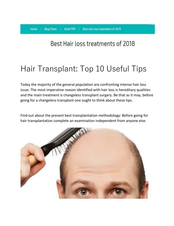 Hair Transplant: Top 10 Useful Tips https://hairtransplant2019.wordpress.com/2018/09/26/hair-transplant-top-10-useful-ti