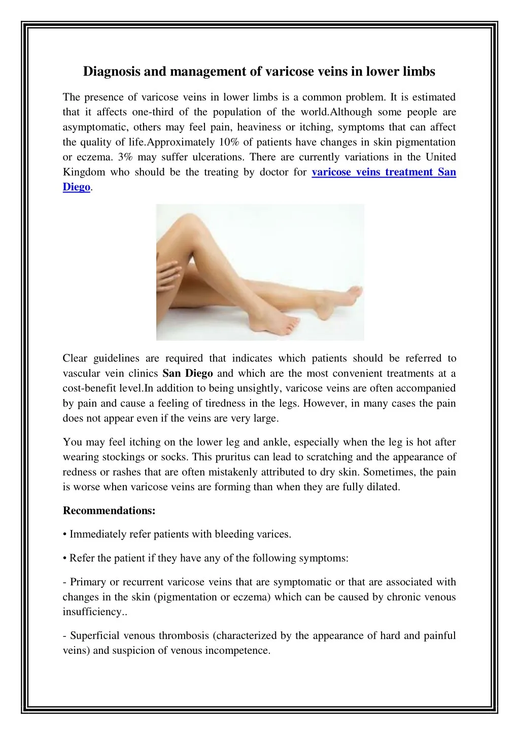 diagnosis and management of varicose veins