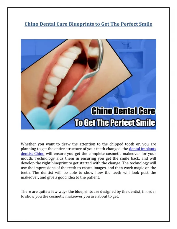 Chino Dental Care Blueprints to Get The Perfect Smile