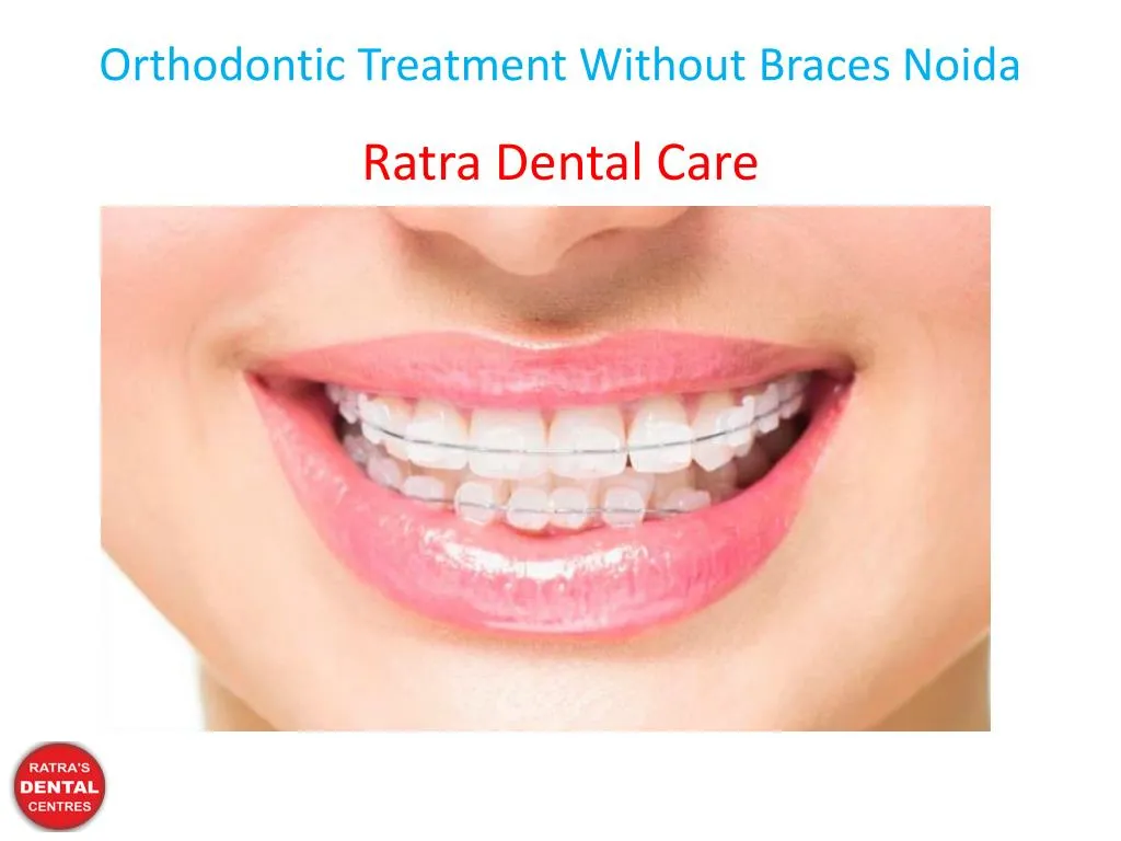 orthodontic treatment without braces noida