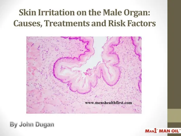 Skin Irritation on the Male Organ: Causes, Treatments and Risk Factors