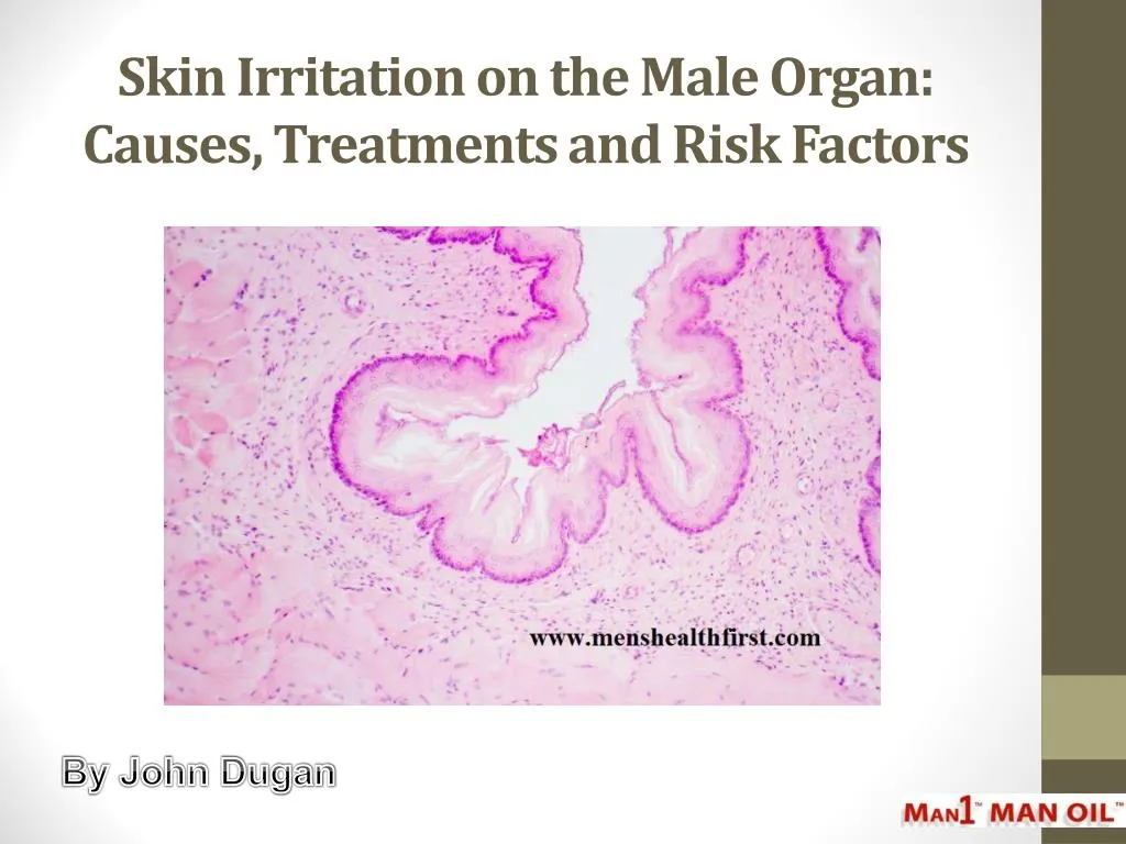 skin irritation on the male organ causes treatments and risk factors