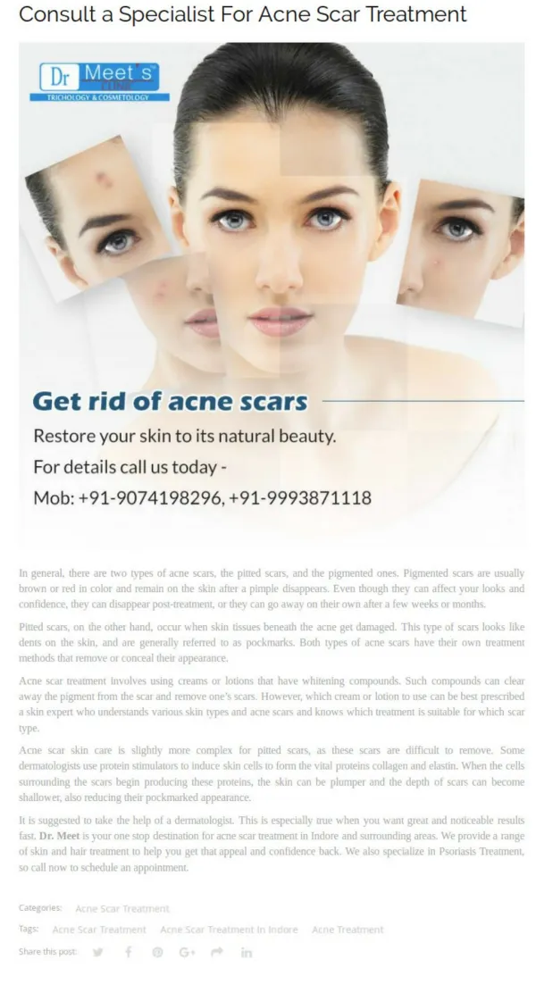 Consult a Specialist For Acne Scar Treatment