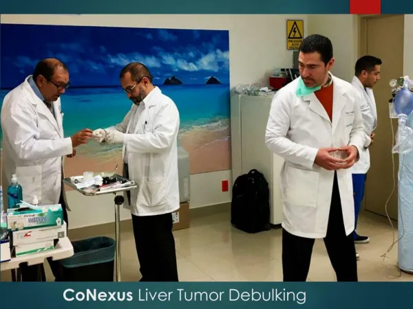 CoNexus Liver Tumor Debulking