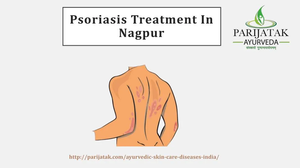 psoriasis treatment in nagpur