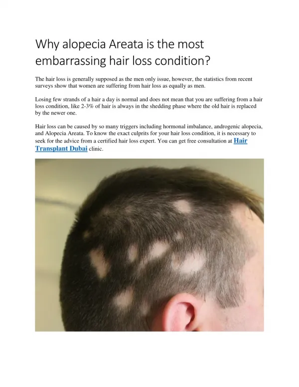 Why alopecia Areata is the most embarrassing hair loss condition?