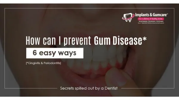 How can I Prevent Gum Disease - 6 Easy Ways