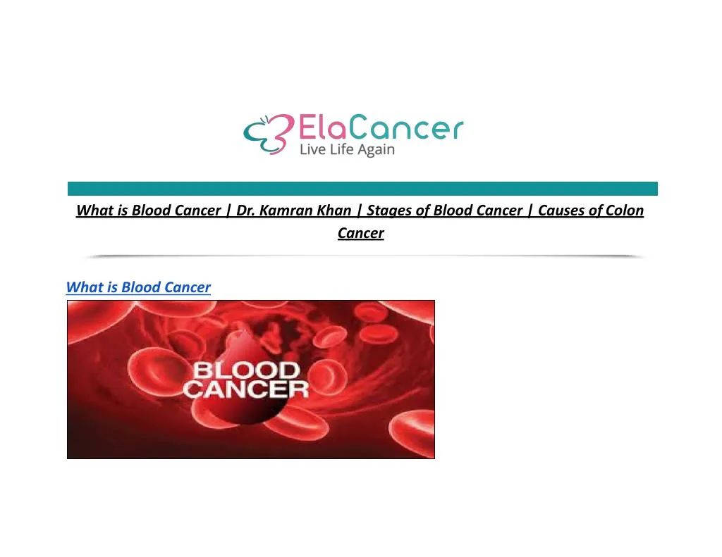 what is blood cancer dr kamran khan stages