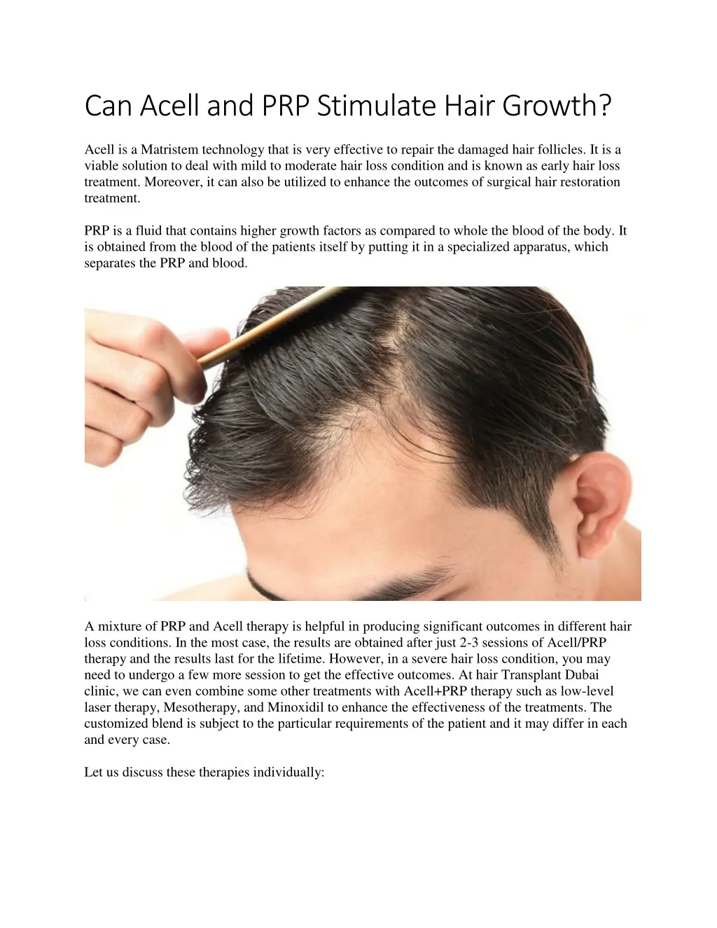 can acell and prp stimulate hair growth