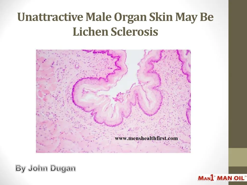 unattractive male organ skin may be lichen sclerosis