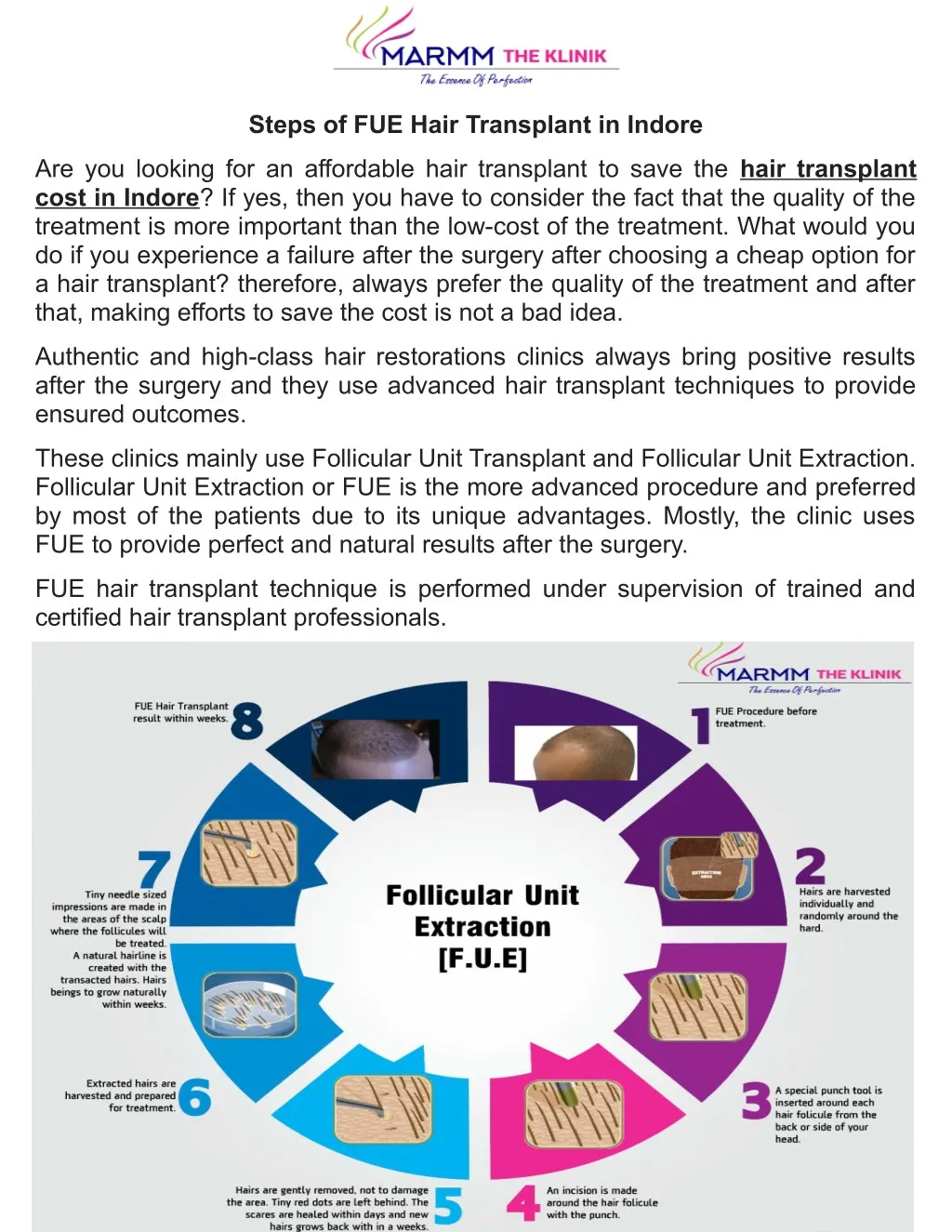 steps of fue hair transplant in indore