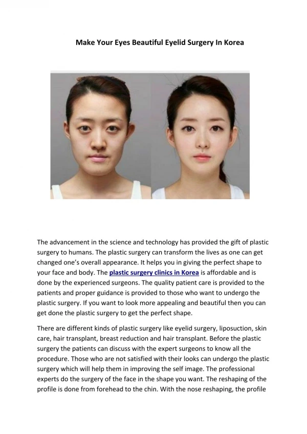 Make Your Eyes Beautiful Eyelid Surgery In Korea