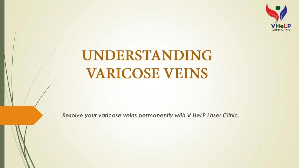 understanding varicose veins