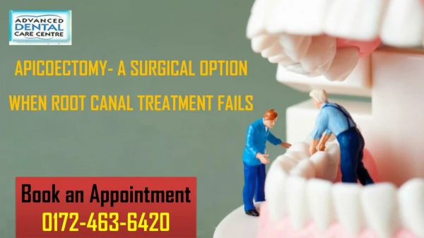 Apicoectomy- A Surgical Option When Root Canal Treatment Fails