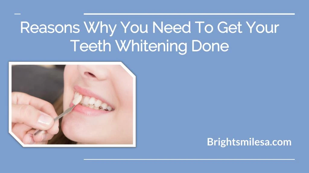 reasons why you need to get your teeth whitening done