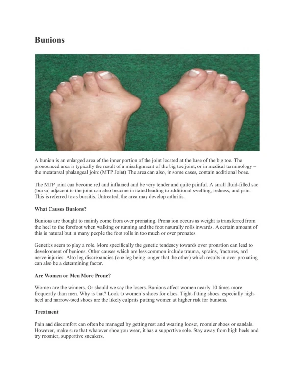 Heel Pain Institute of America Offers Bunion Treatment For The Patients