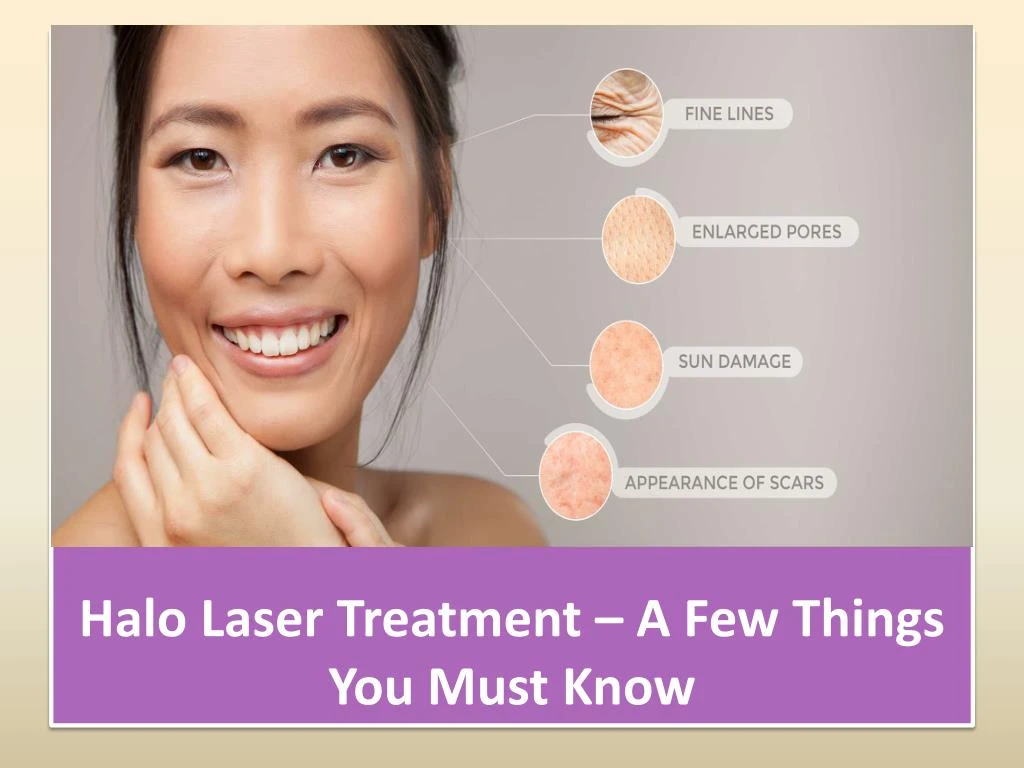halo laser treatment a few things you must know