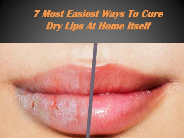 7 Most Easiest Ways To Cure Dry Lips At Home Itself
