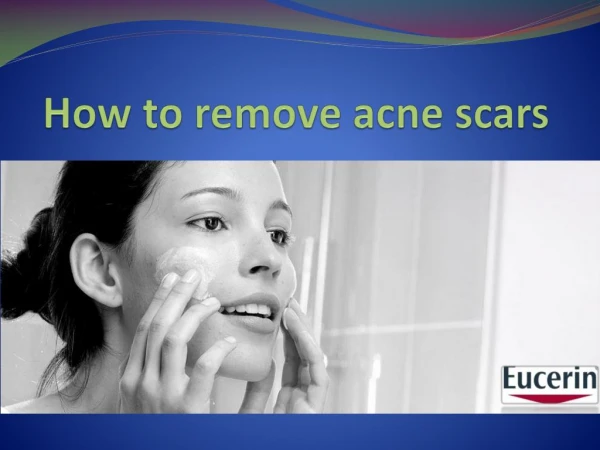 How to remove acne scars -without Medication