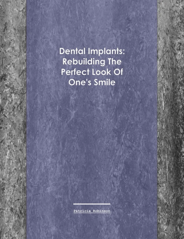 Dental Implants: Rebuilding The Perfect Look Of One's Smile