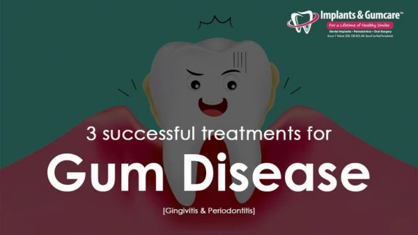 3 Successful Treatments for Gum Disease