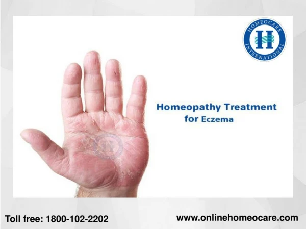 Homeopathy treatment for Eczema