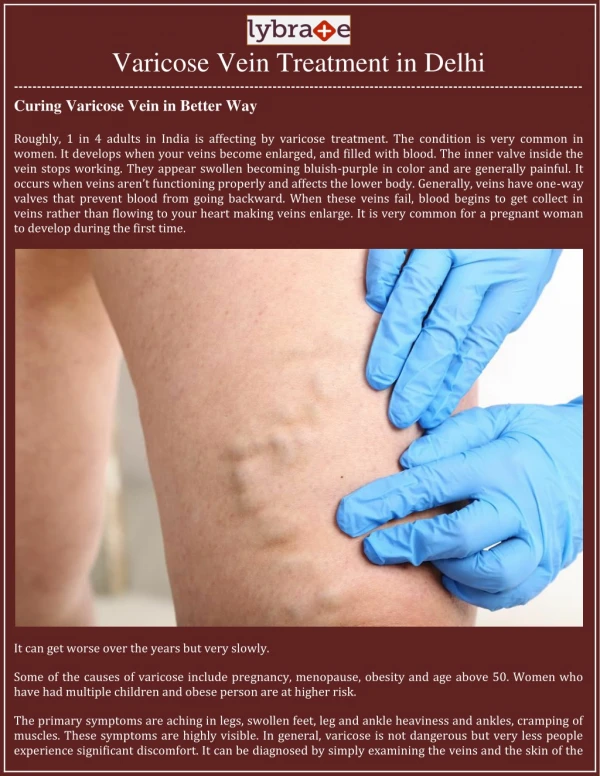 Curing Varicose Vein in Better Way