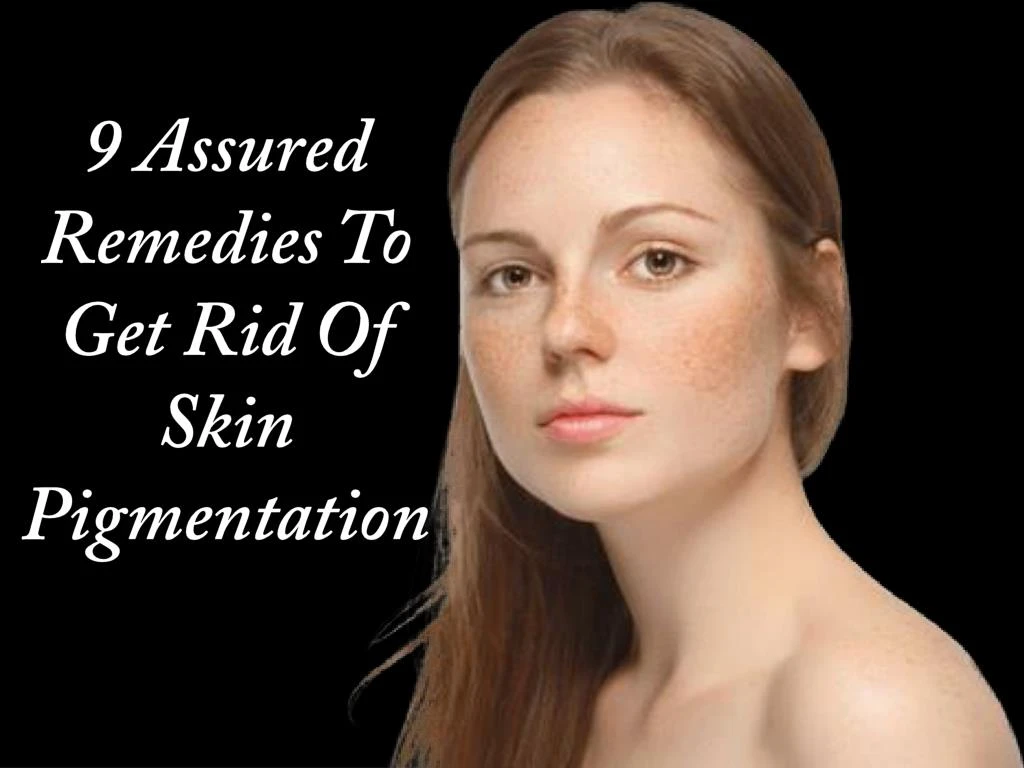 9 assured remedies to get rid of skin pigmentation