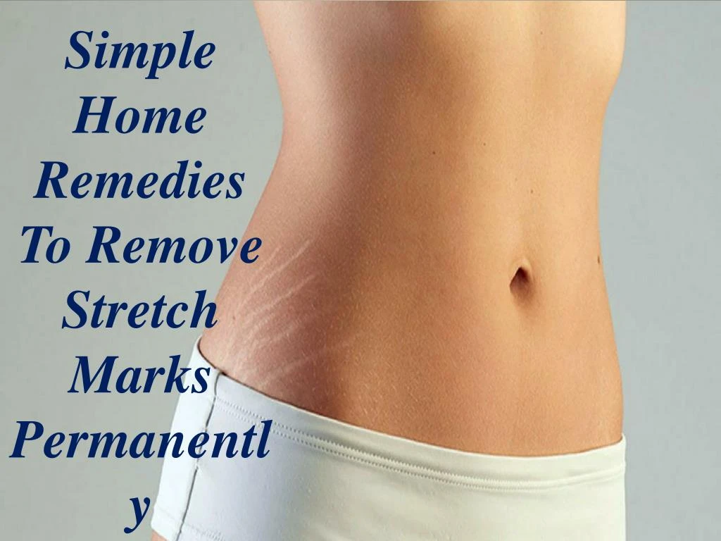 simple home remedies to remove stretch marks
