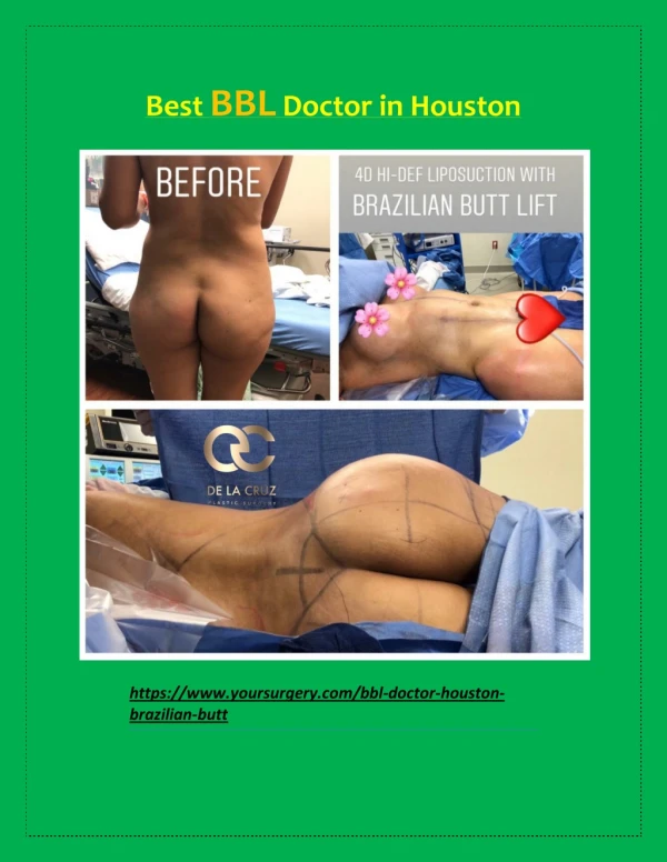 Best BBL Doctor in Houston