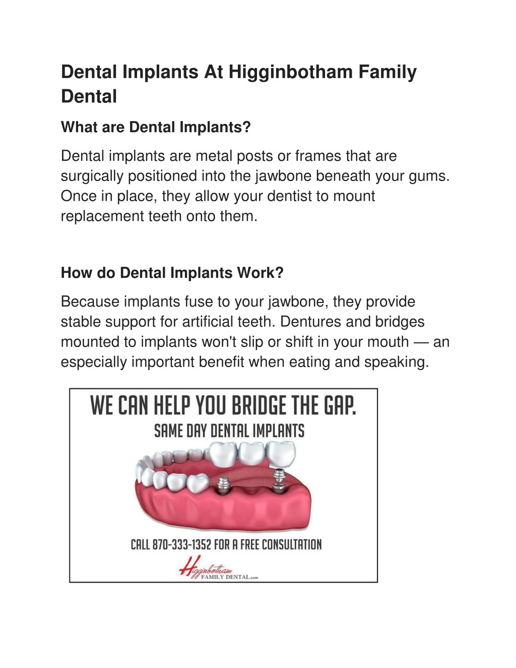 dental implants at higginbotham family dental