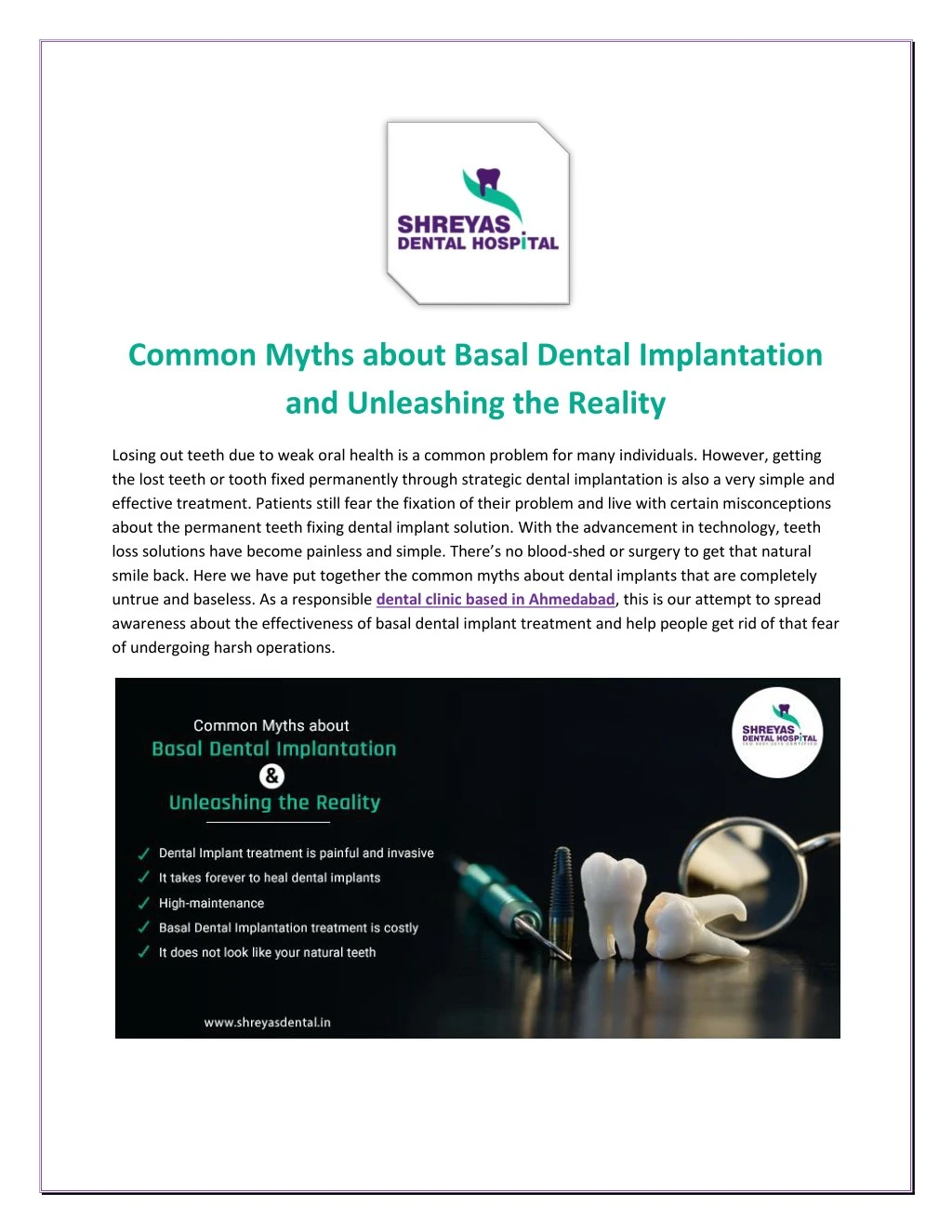 common myths about basal dental implantation