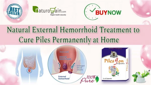 Natural External Hemorrhoid Treatment to Cure Piles Permanently at Home