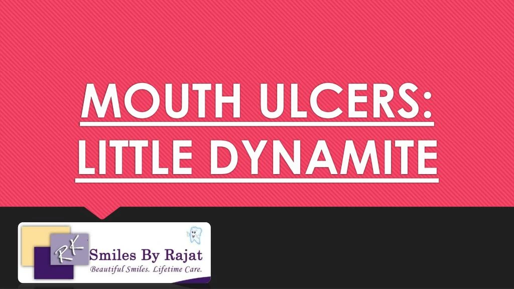 mouth ulcers little dynamite