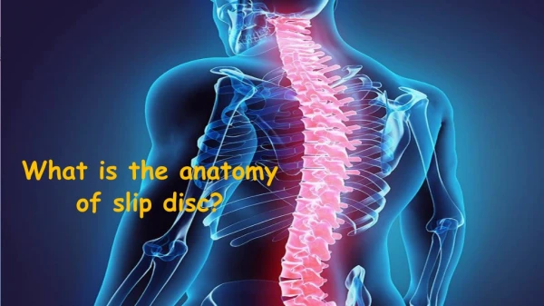 What is the anatomy of slip disc?