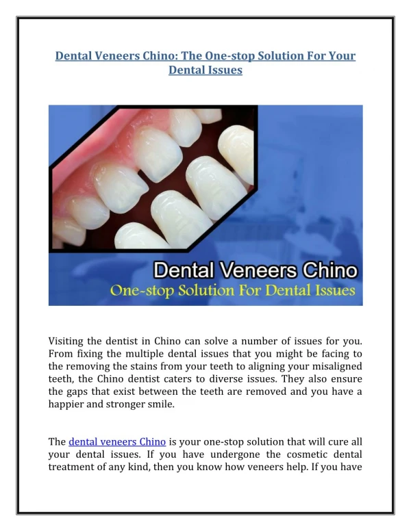 Dental Veneers Chino - The One-stop Solution For Your Dental Issues