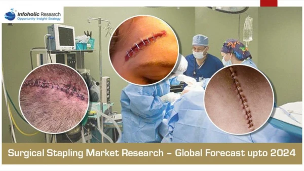 Global Surgical Stapling Market forecast 2018–2024
