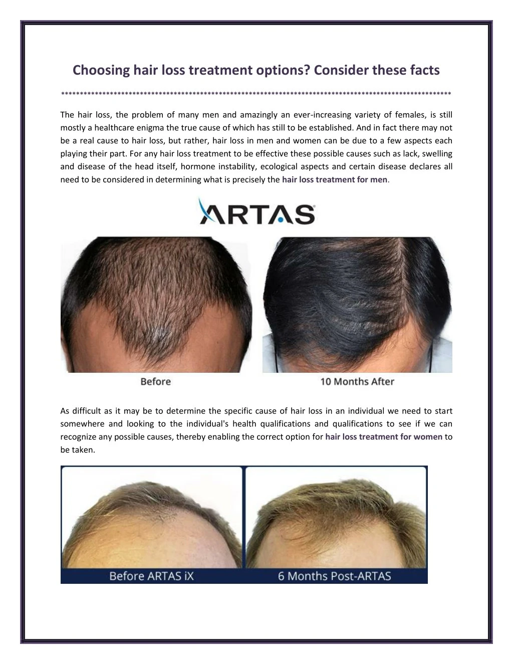choosing hair loss treatment options consider