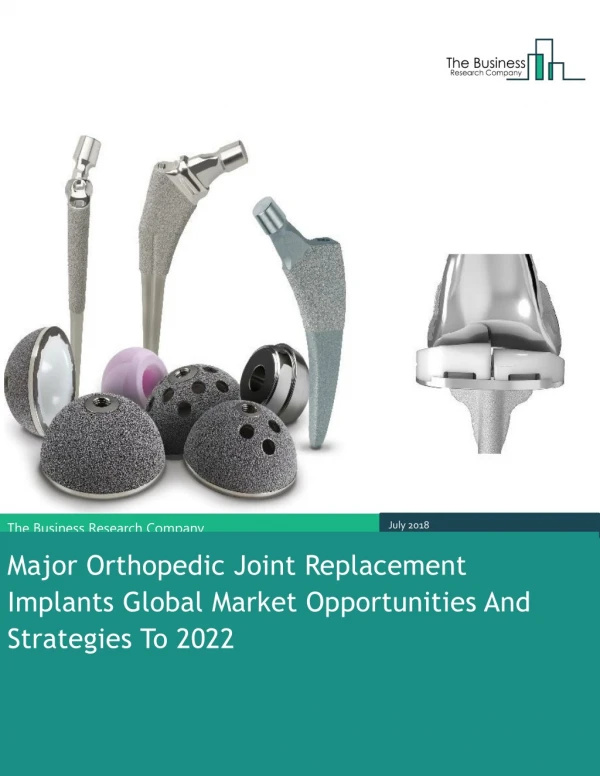 Major Orthopedic Joint Replacement Implants Global Market Opportunities And Strategies To 2022