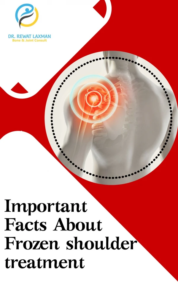 Important Facts About Frozen shoulder treatment by Dr. Rewat Laxman|Frozen shoulder treatment in Koramangala Bangalore
