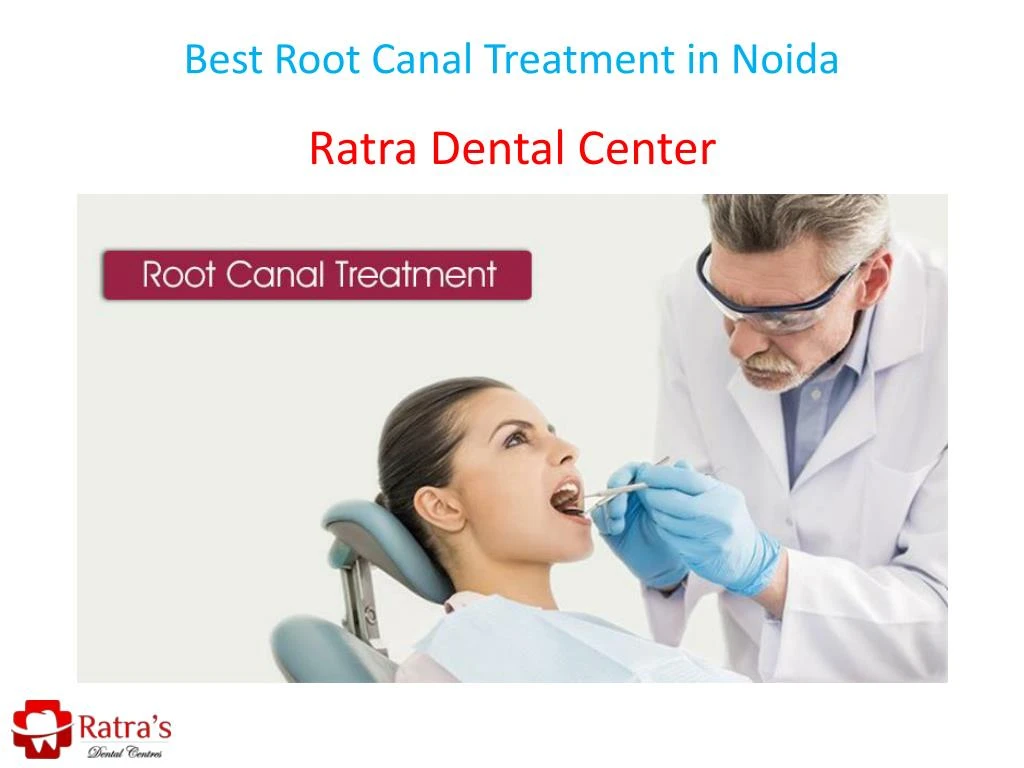 best root canal treatment in noida