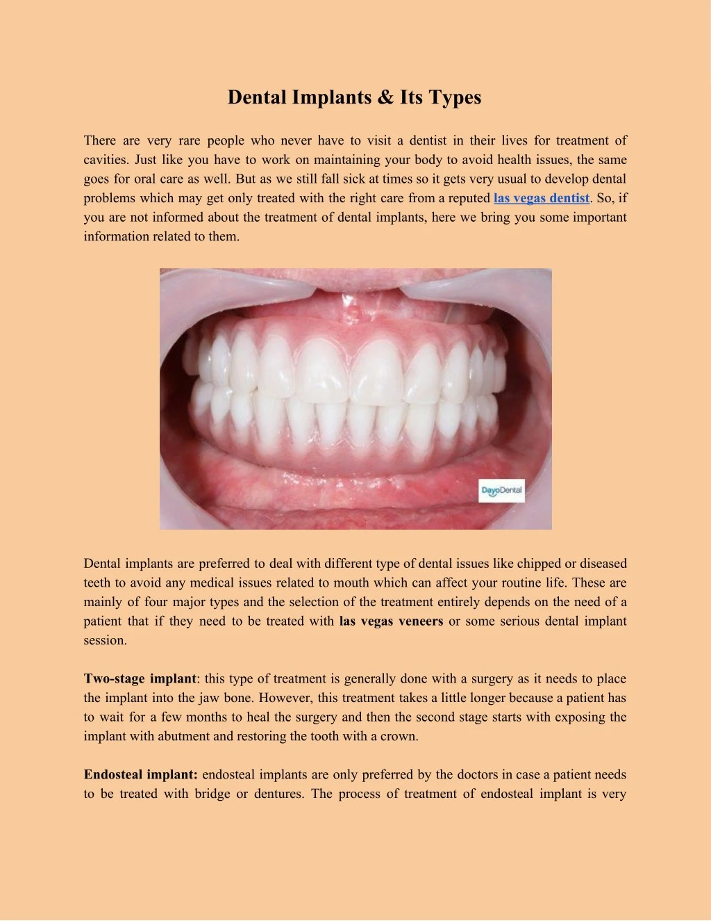 dental implants its types