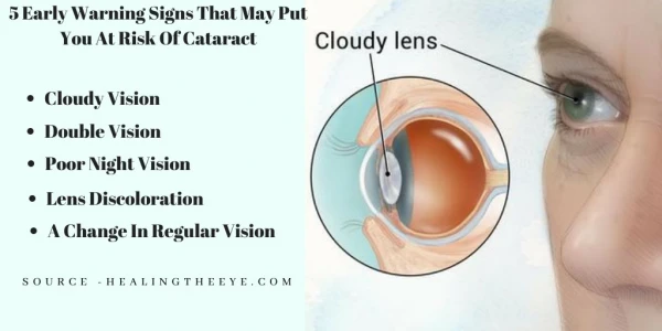 5 Early Warning Signs That May Put You At Risk Of Cataract