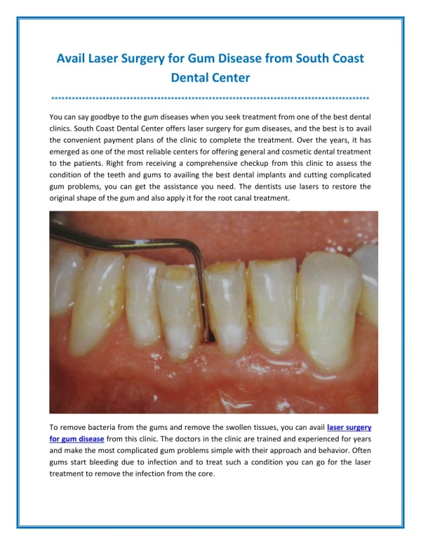 Avail Laser Surgery for Gum Disease from South Coast Dental Center