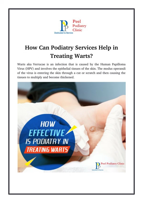 How Can Podiatry Services Help in Treating Warts?