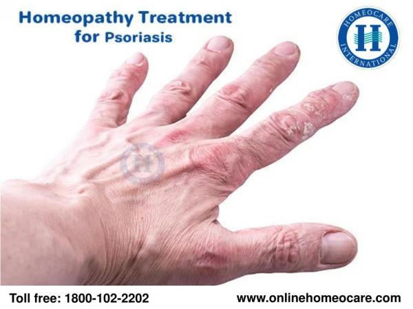 Effective Homeopathy Treatment For Psoriasis
