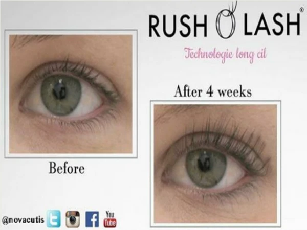 Best Eyelash Growth Serum Before and After