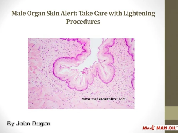 Male Organ Skin Alert: Take Care with Lightening Procedures